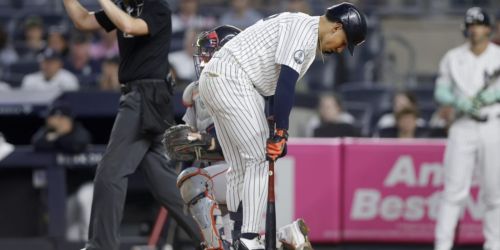 Lombard (right knee discomfort) expected to be day to day